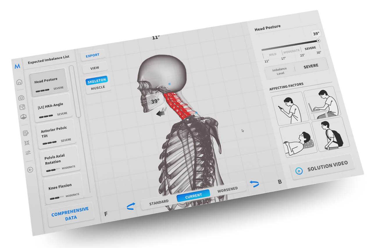 MotiPhysio egy korszerű, mesterséges intelligenciával működő diagnosztikai rendszer